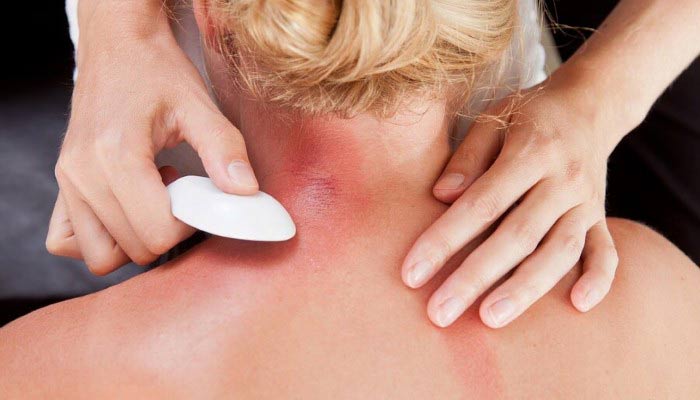 gua sha iastm gua sha iastm